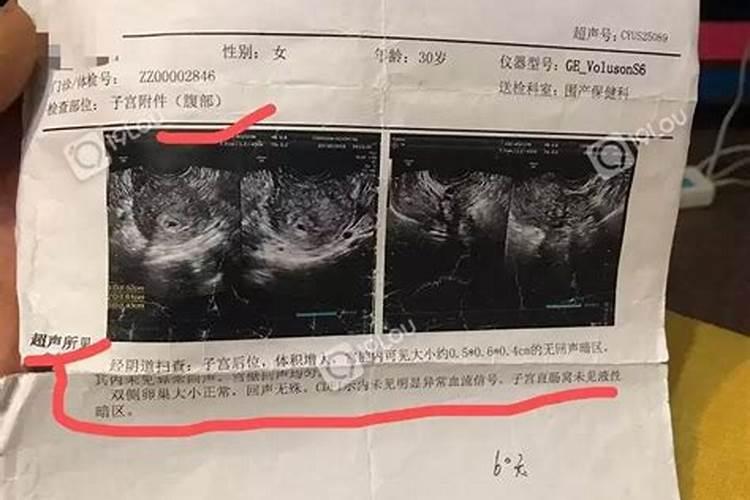 事业成功的人婚姻不幸福