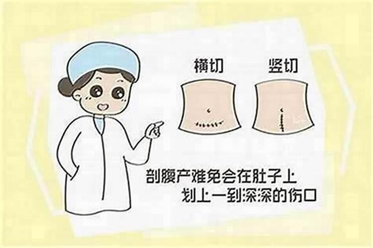 看好日子剖腹产 剖腹产八字准