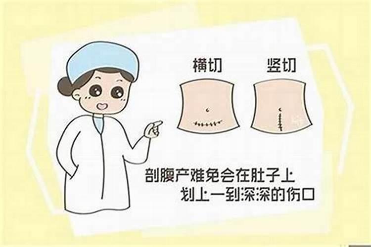 剖腹产八字准确率