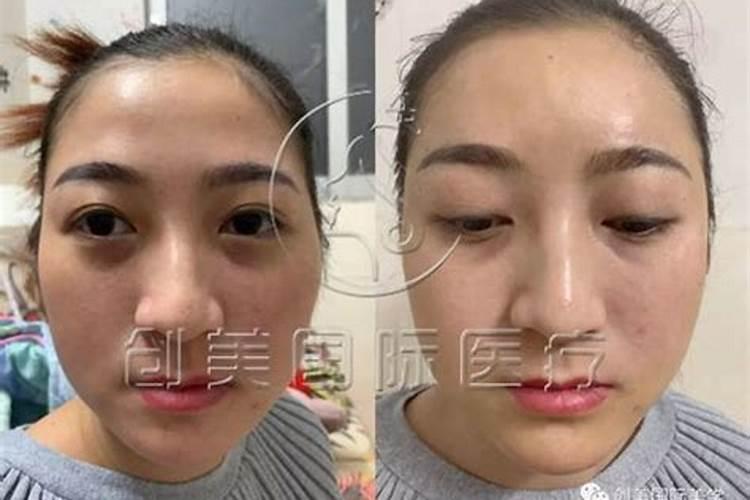 太阳凹陷的人婚姻不顺吗