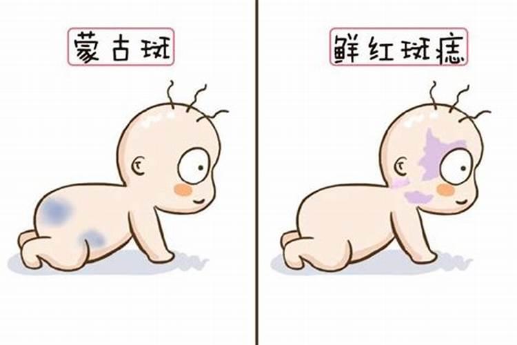 带胎记的孩子寓意是什么