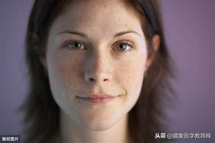 女人脸上长痣婚姻不顺